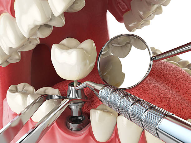 Best Emergency Broken Tooth Repair in Greenville, FL